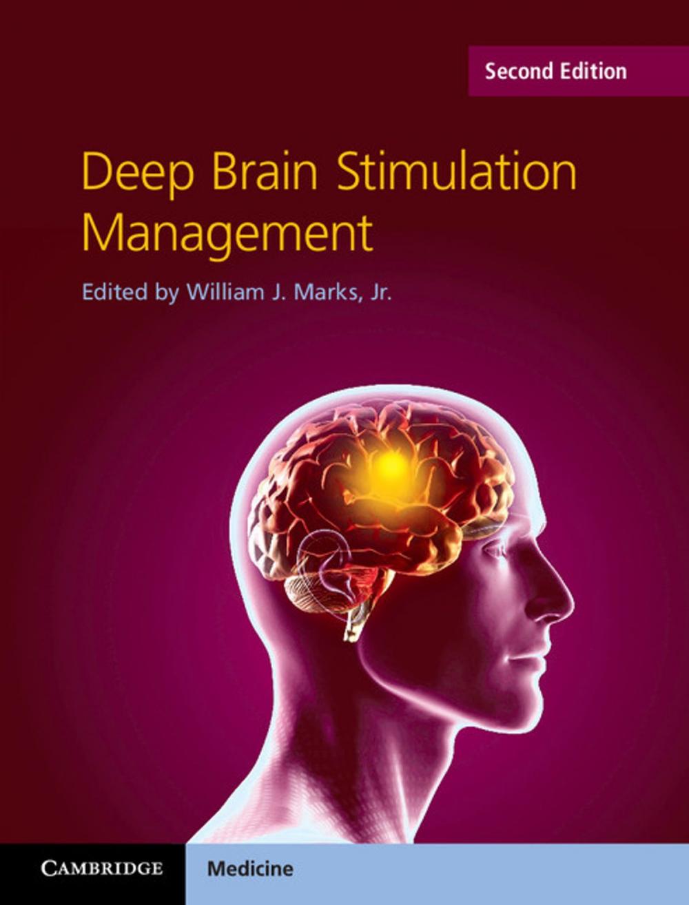 Big bigCover of Deep Brain Stimulation Management