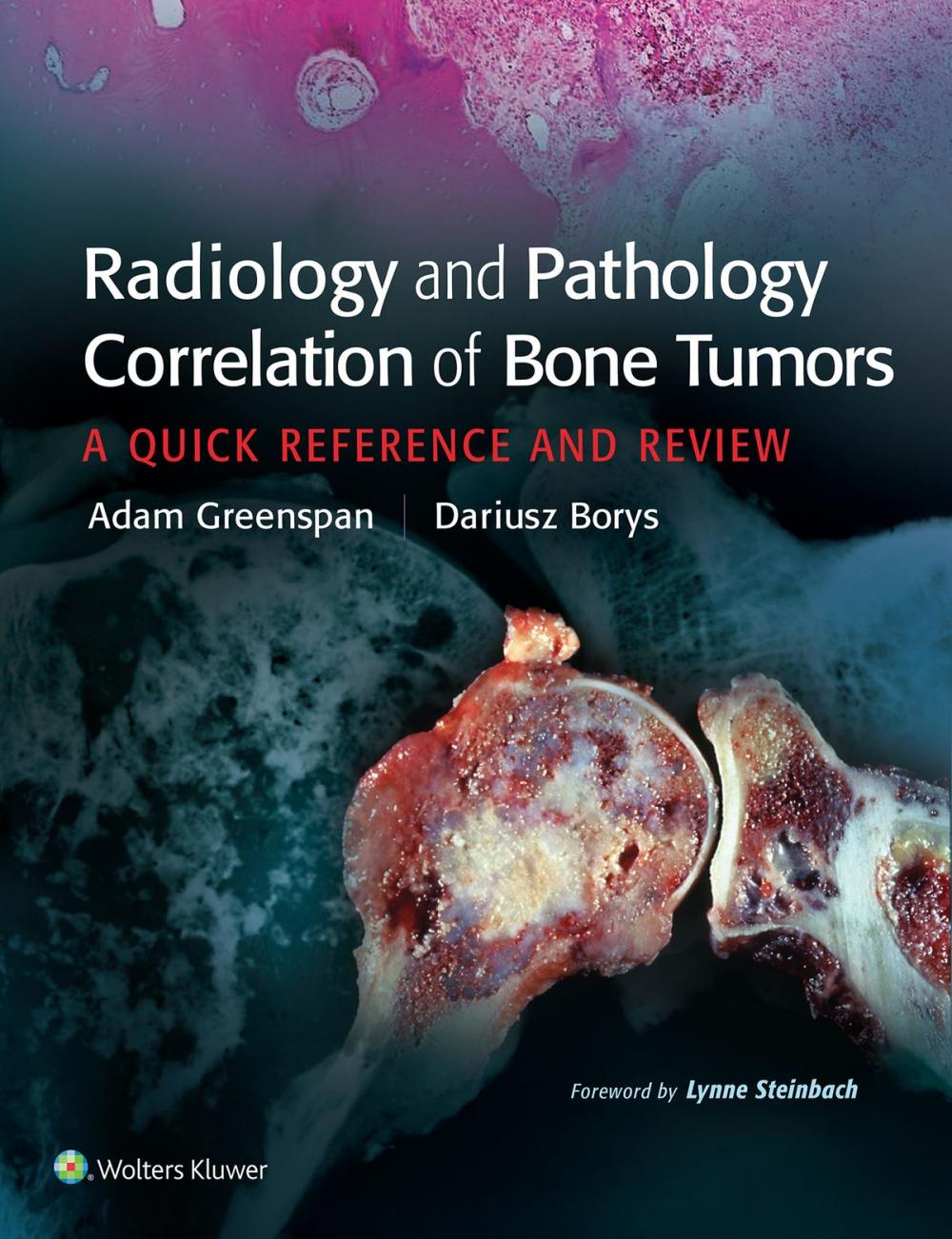 Big bigCover of Radiology and Pathology Correlation of Bone Tumors, None