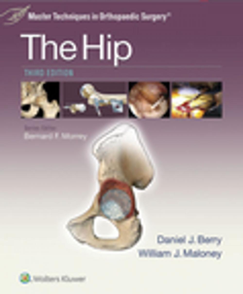 Big bigCover of Master Techniques in Orthopaedic Surgery: The Hip