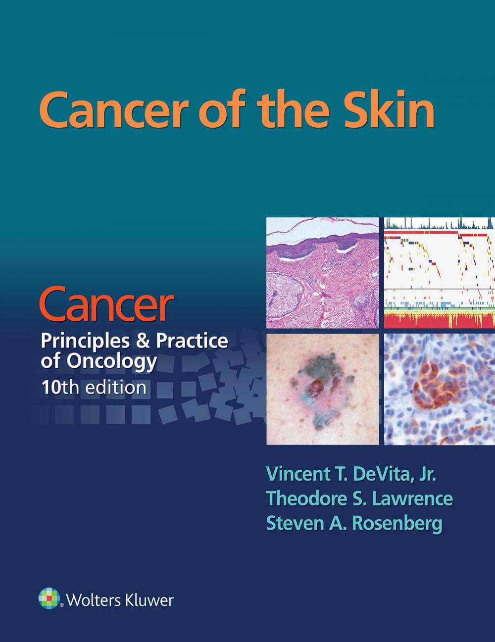 Big bigCover of Cancer of the Skin