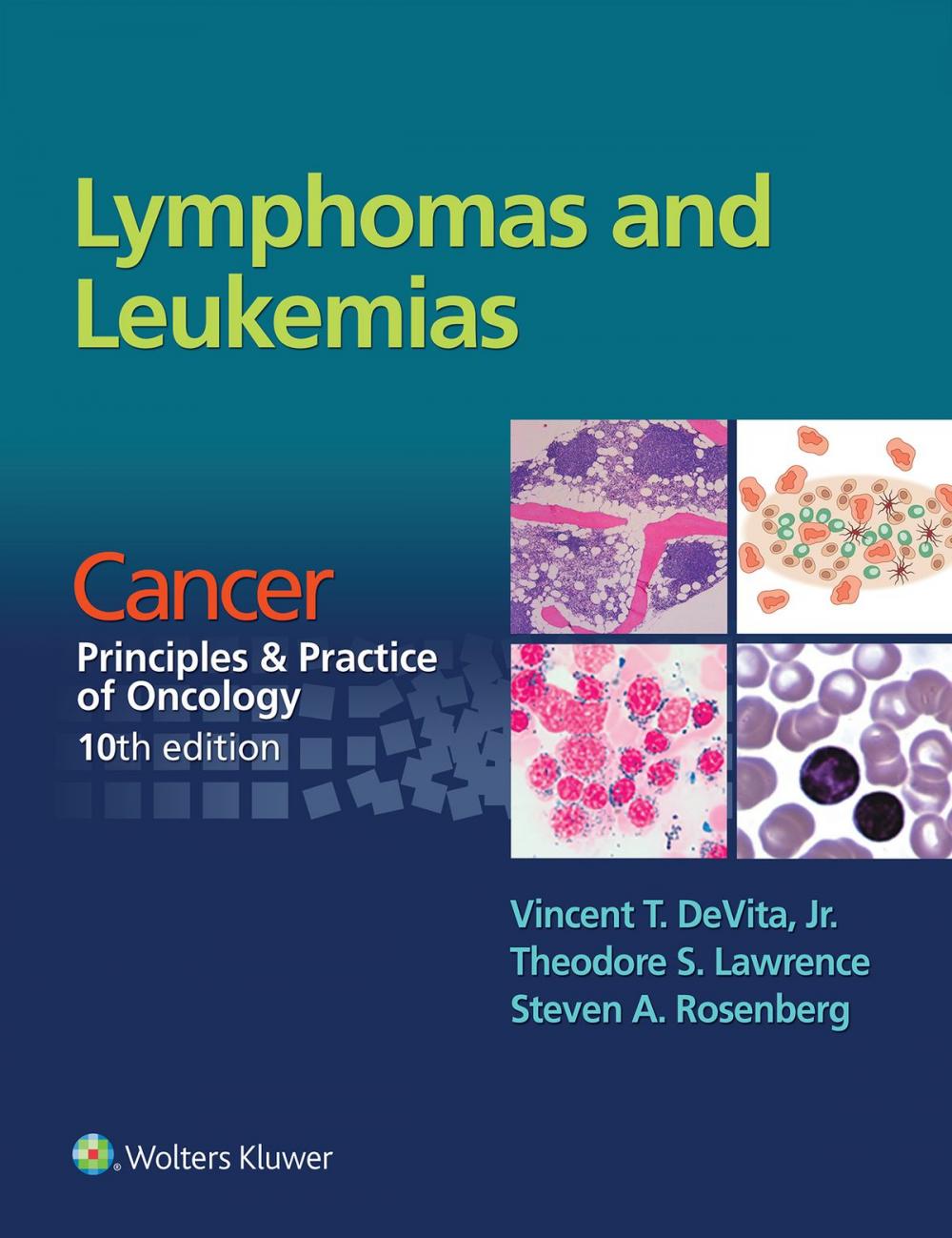 Big bigCover of Lymphomas and Leukemias