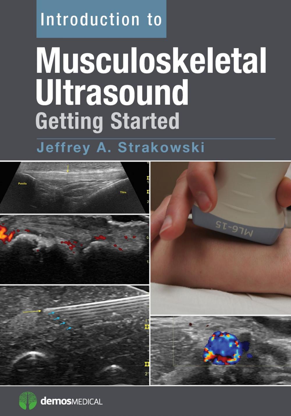 Big bigCover of Introduction to Musculoskeletal Ultrasound