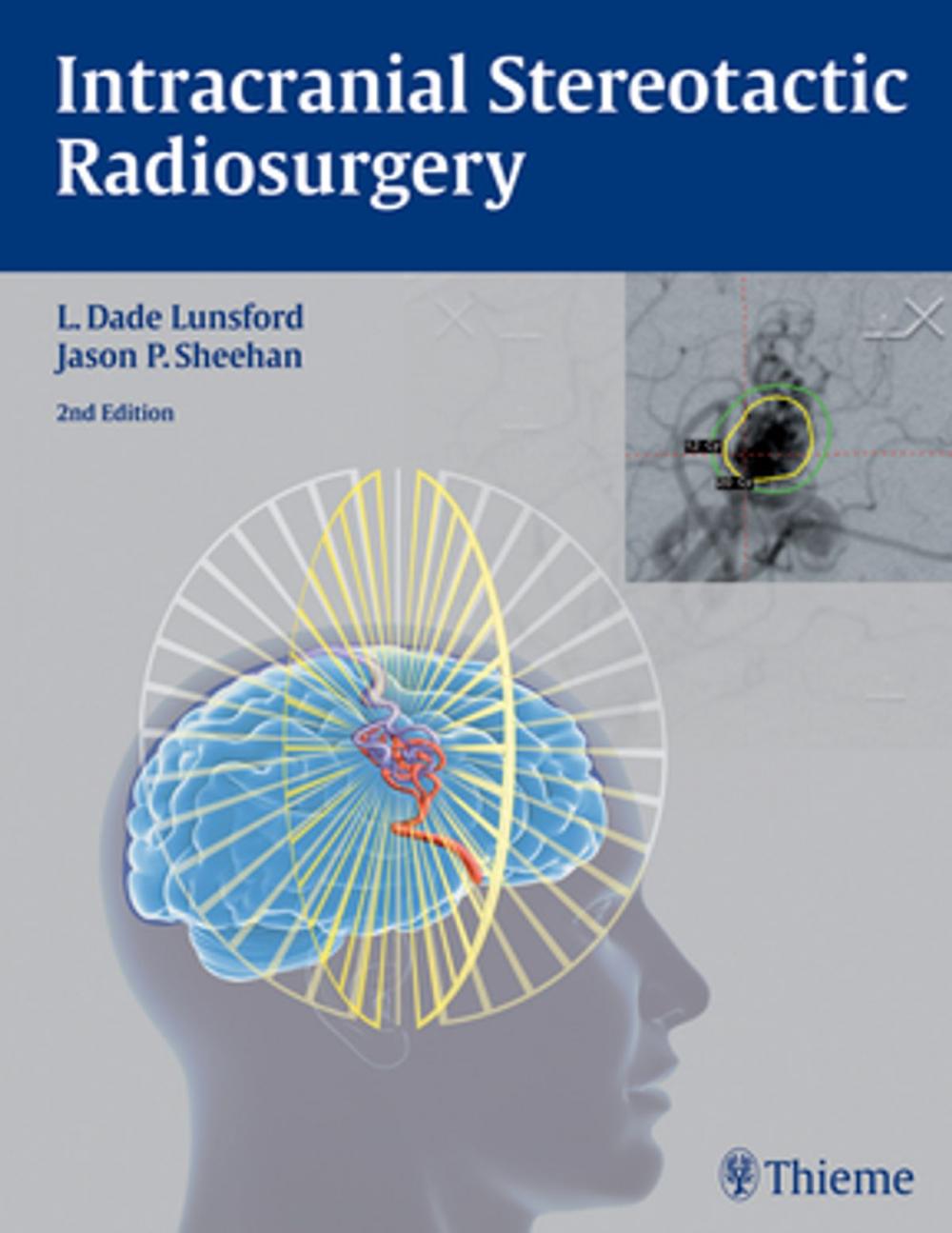 Big bigCover of Intracranial Stereotactic Radiosurgery