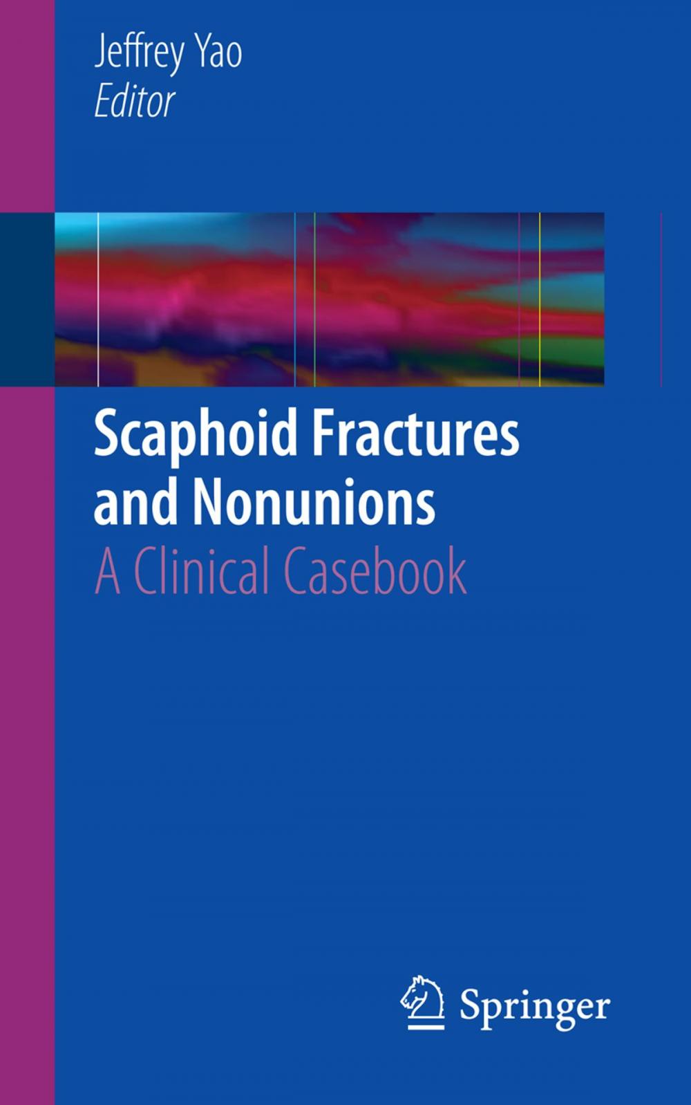 Big bigCover of Scaphoid Fractures and Nonunions