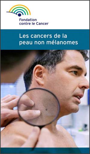 Book cover of Les cancers de la peau non mélanomes