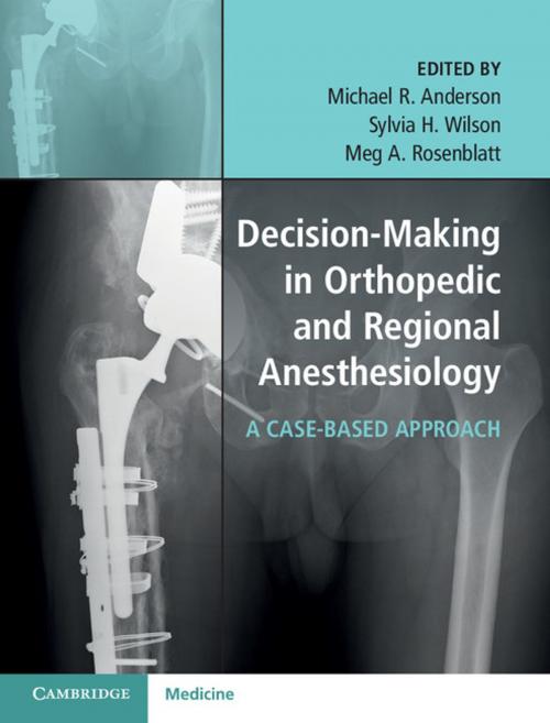 Cover of the book Decision-Making in Orthopedic and Regional Anesthesiology by , Cambridge University Press
