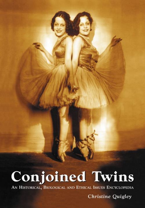 Cover of the book Conjoined Twins by Christine Quigley, McFarland & Company, Inc., Publishers