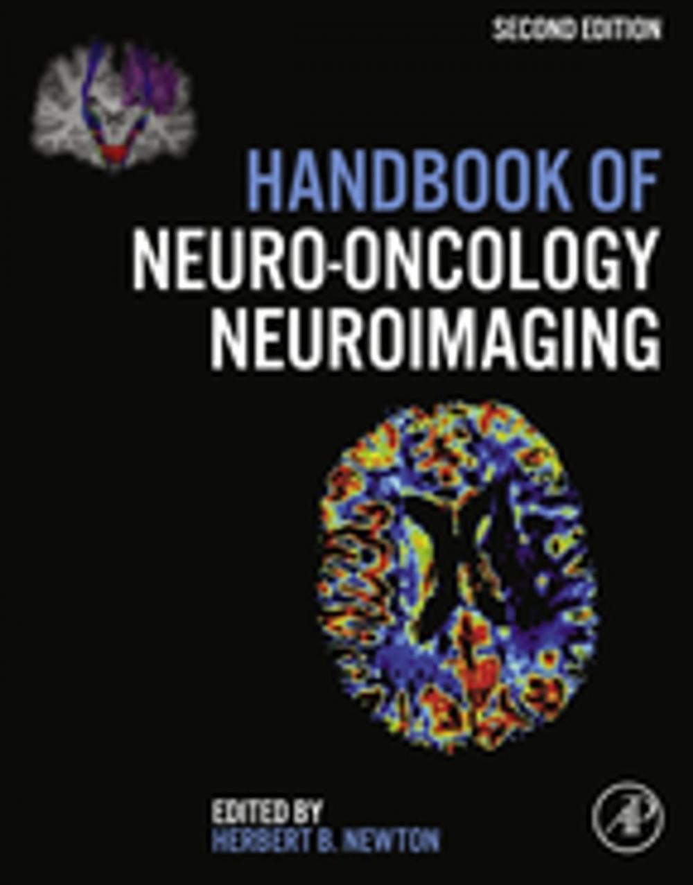 Big bigCover of Handbook of Neuro-Oncology Neuroimaging