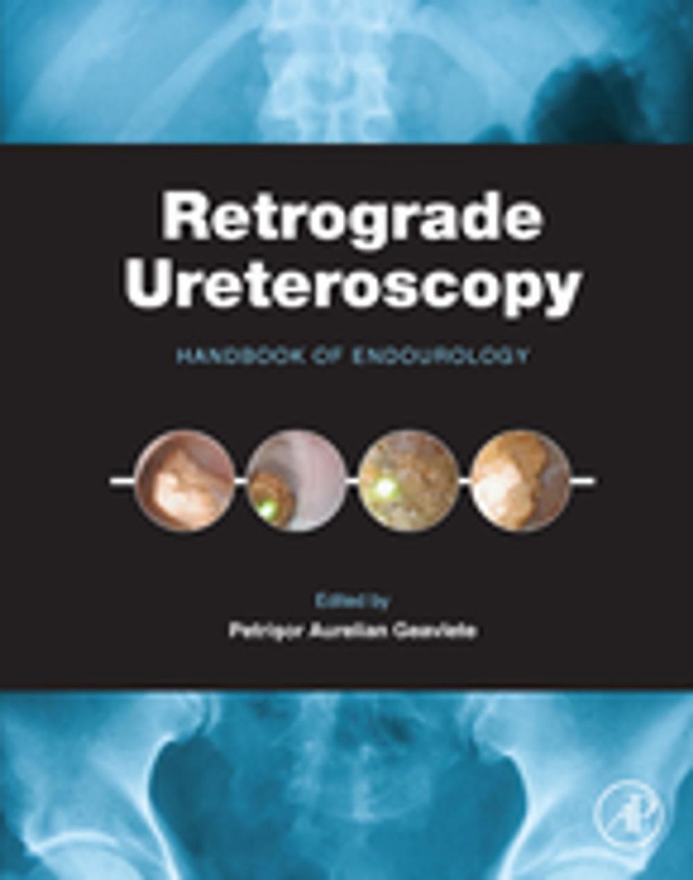 Big bigCover of Retrograde Ureteroscopy