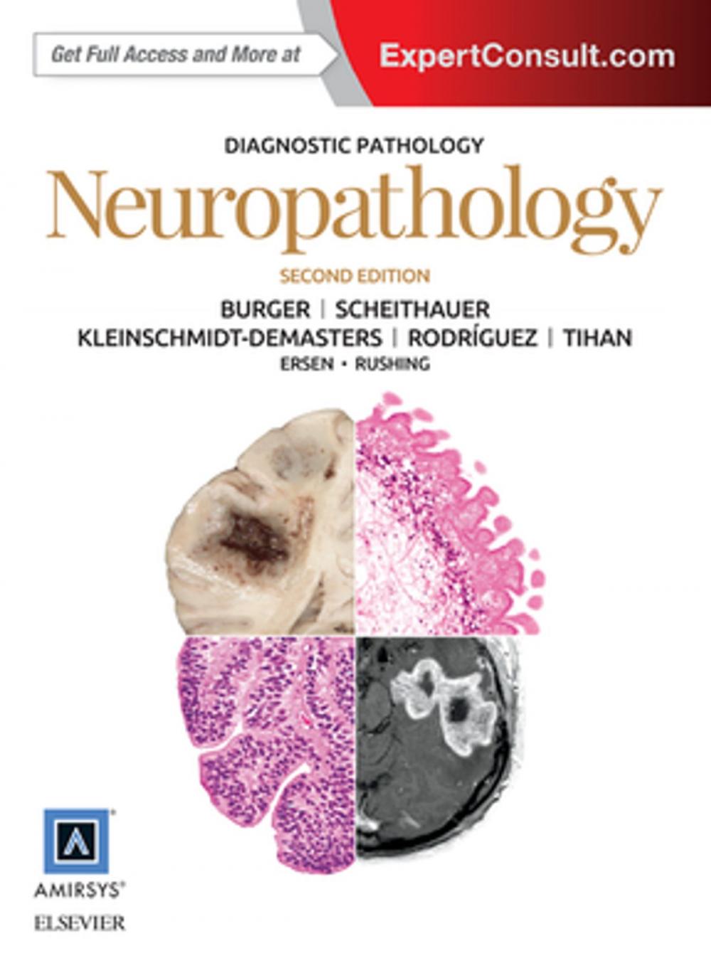 Big bigCover of Diagnostic Pathology: Neuropathology E-Book