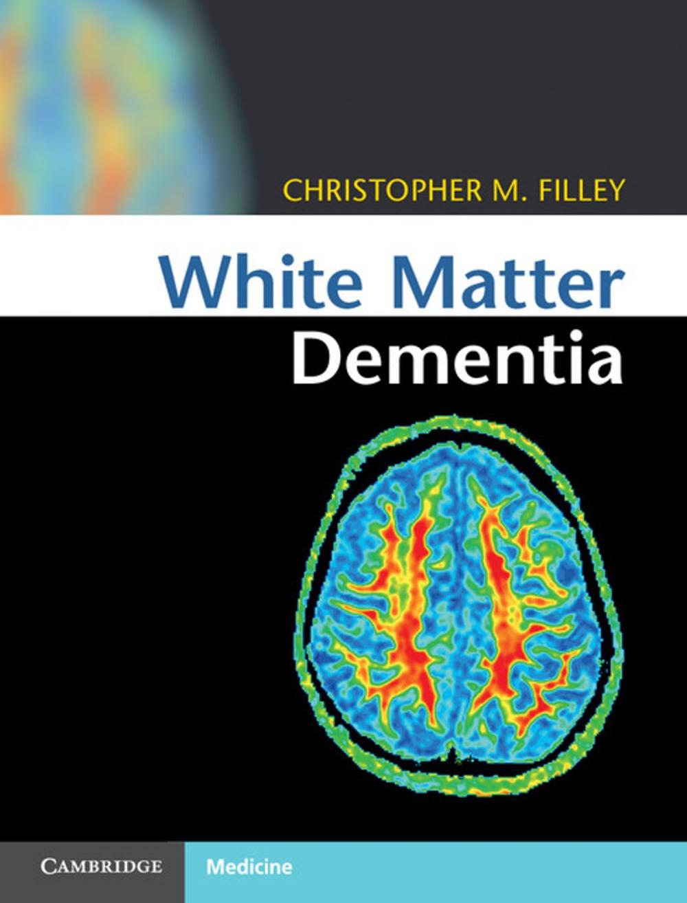 Big bigCover of White Matter Dementia