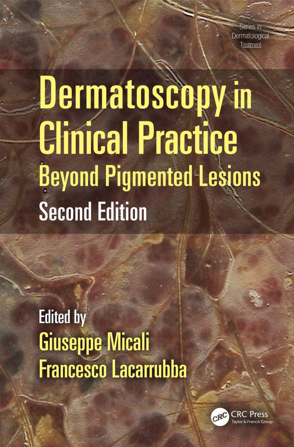 Big bigCover of Dermatoscopy in Clinical Practice