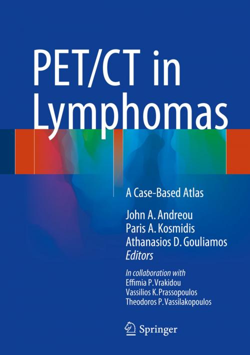 Cover of the book PET/CT in Lymphomas by Effimia P. Vrakidou, Vassilios K. Prassopoulos, Theodoros P. Vassilakopoulos, Springer International Publishing