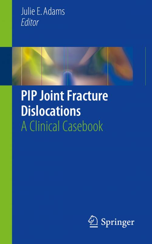 Cover of the book PIP Joint Fracture Dislocations by , Springer International Publishing