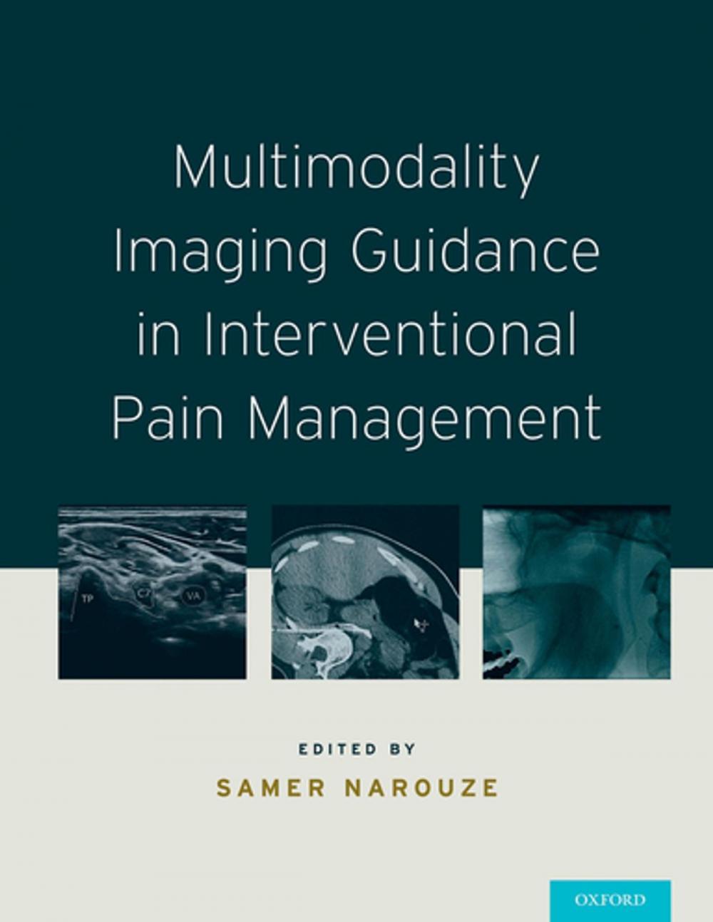Big bigCover of Multimodality Imaging Guidance in Interventional Pain Management