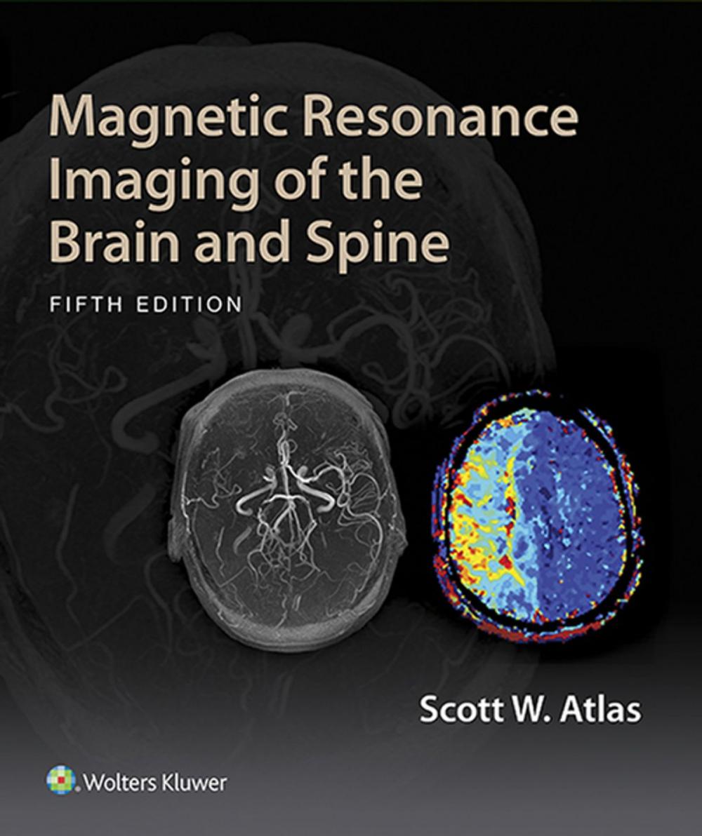 Big bigCover of Magnetic Resonance Imaging of the Brain and Spine