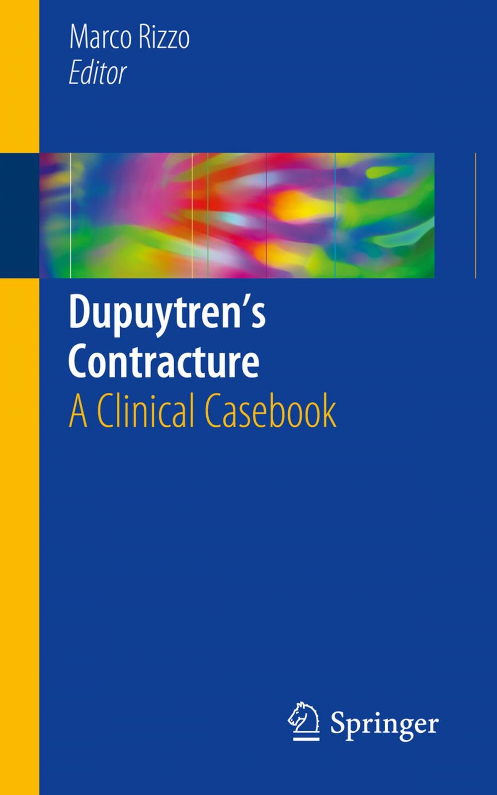 Big bigCover of Dupuytren’s Contracture