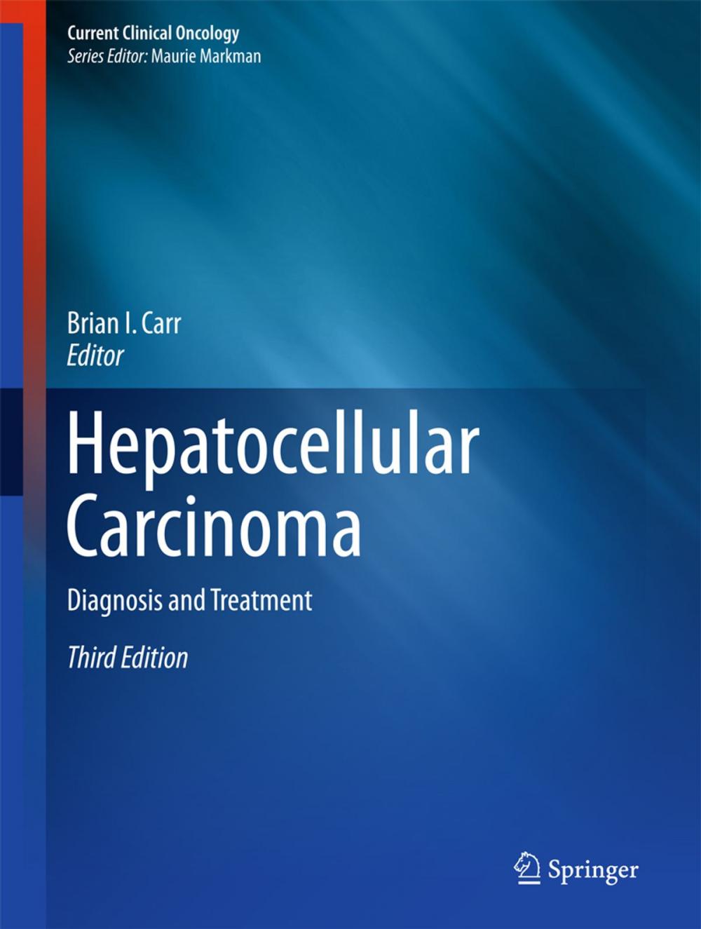 Big bigCover of Hepatocellular Carcinoma