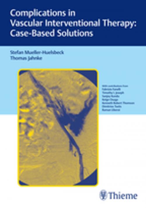 Cover of the book Complications in Vascular Interventional Therapy: Case-Based Solutions by Stefan Mueller-Huelsbeck, Thomas Jahnke, Thieme