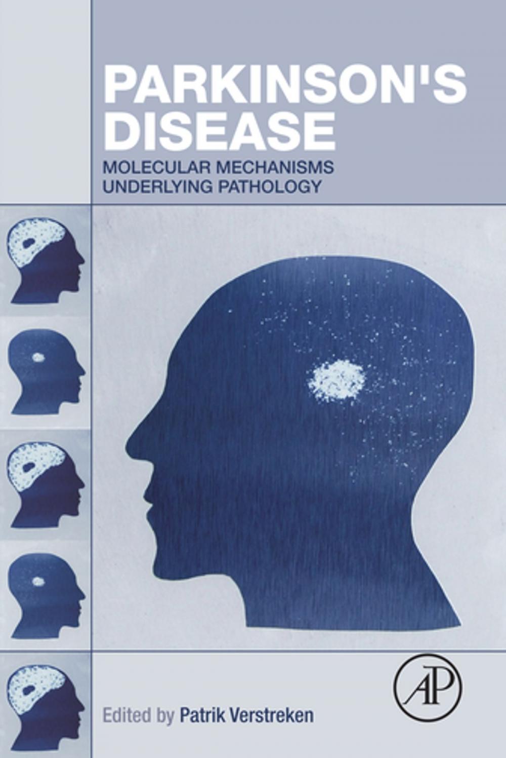 Big bigCover of Parkinson's Disease