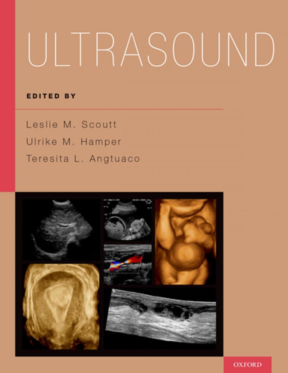Big bigCover of Ultrasound