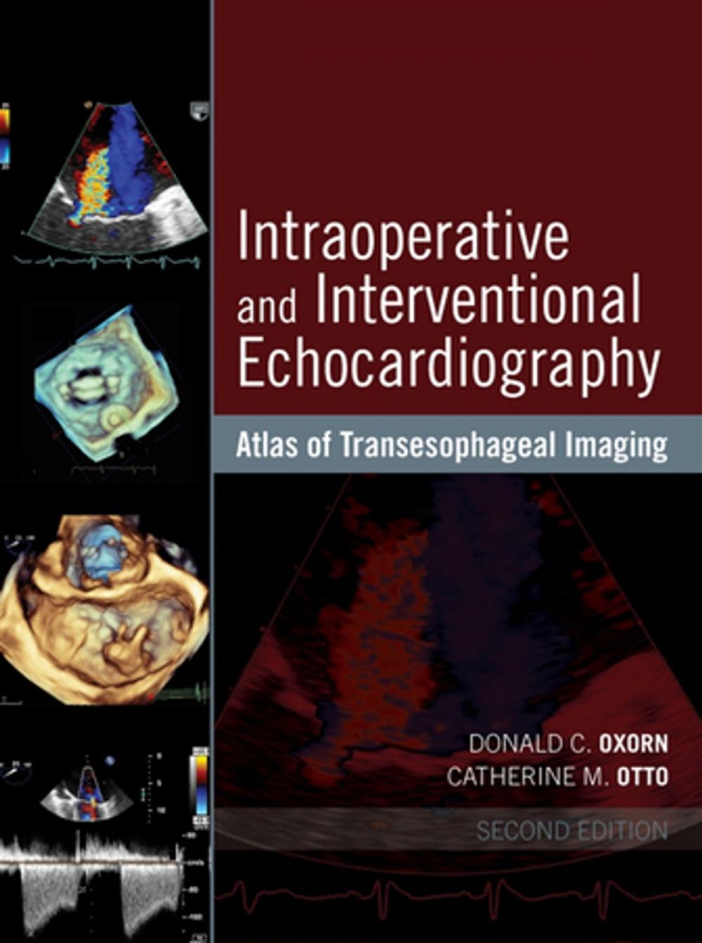 Big bigCover of Intraoperative and Interventional Echocardiography