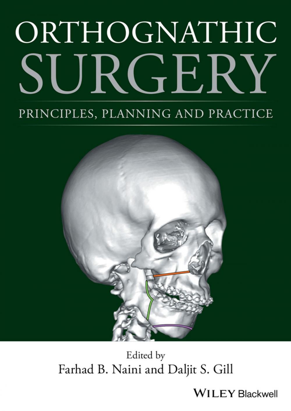 Big bigCover of Orthognathic Surgery