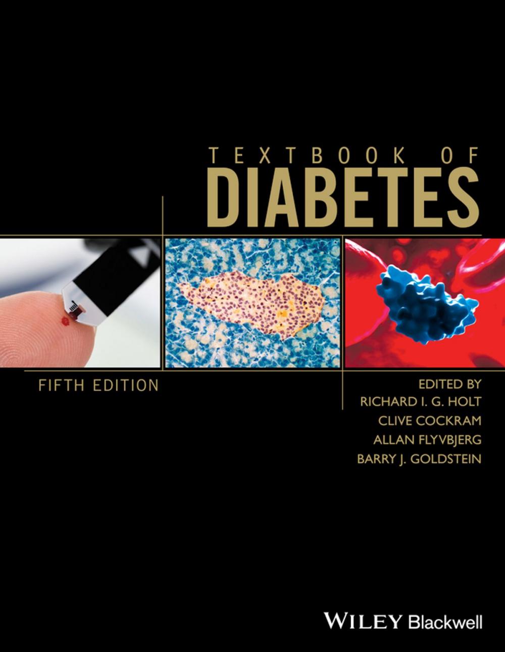 Big bigCover of Textbook of Diabetes