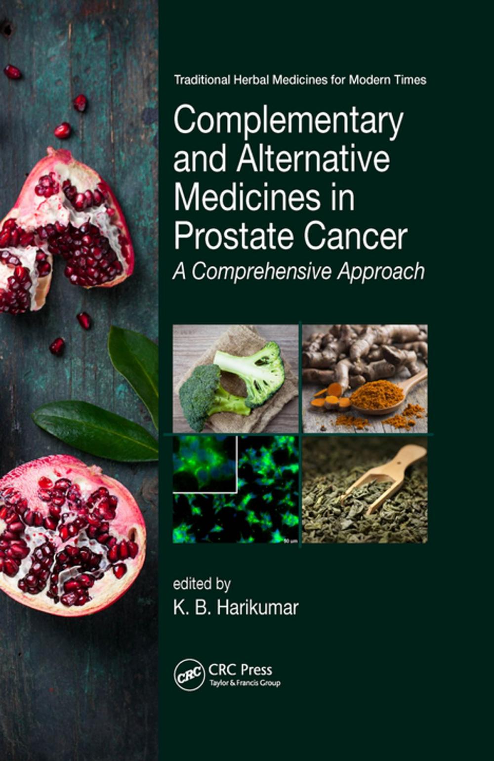 Big bigCover of Complementary and Alternative Medicines in Prostate Cancer