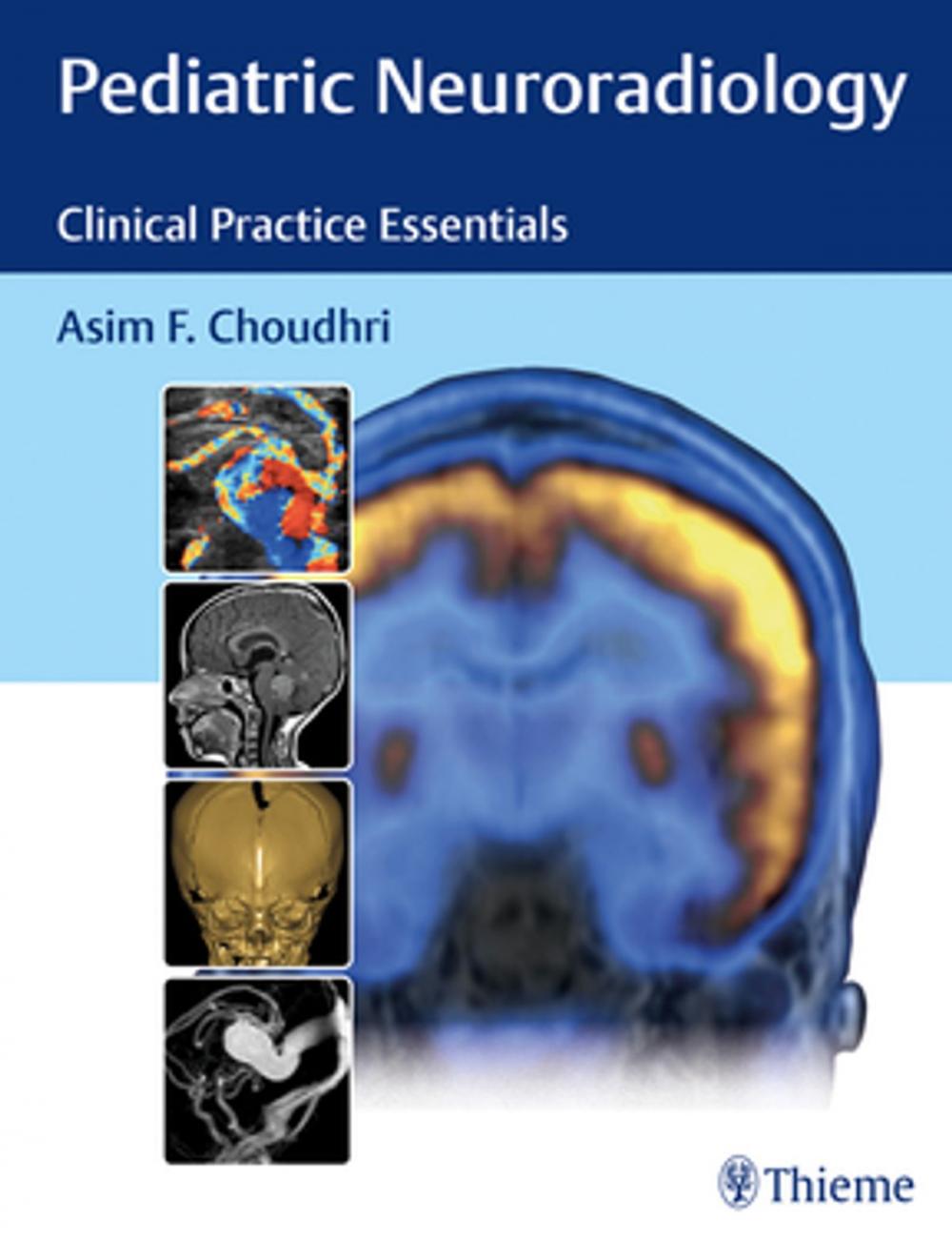 Big bigCover of Pediatric Neuroradiology