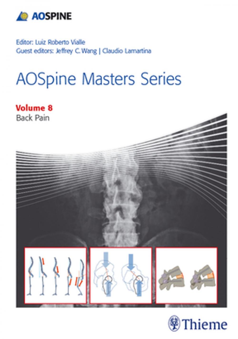 Big bigCover of AOSpine Masters Series, Volume 8: Back Pain