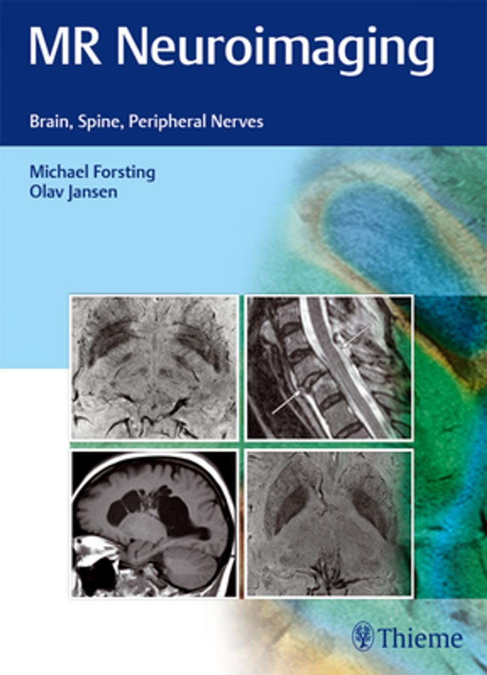 Big bigCover of MR Neuroimaging