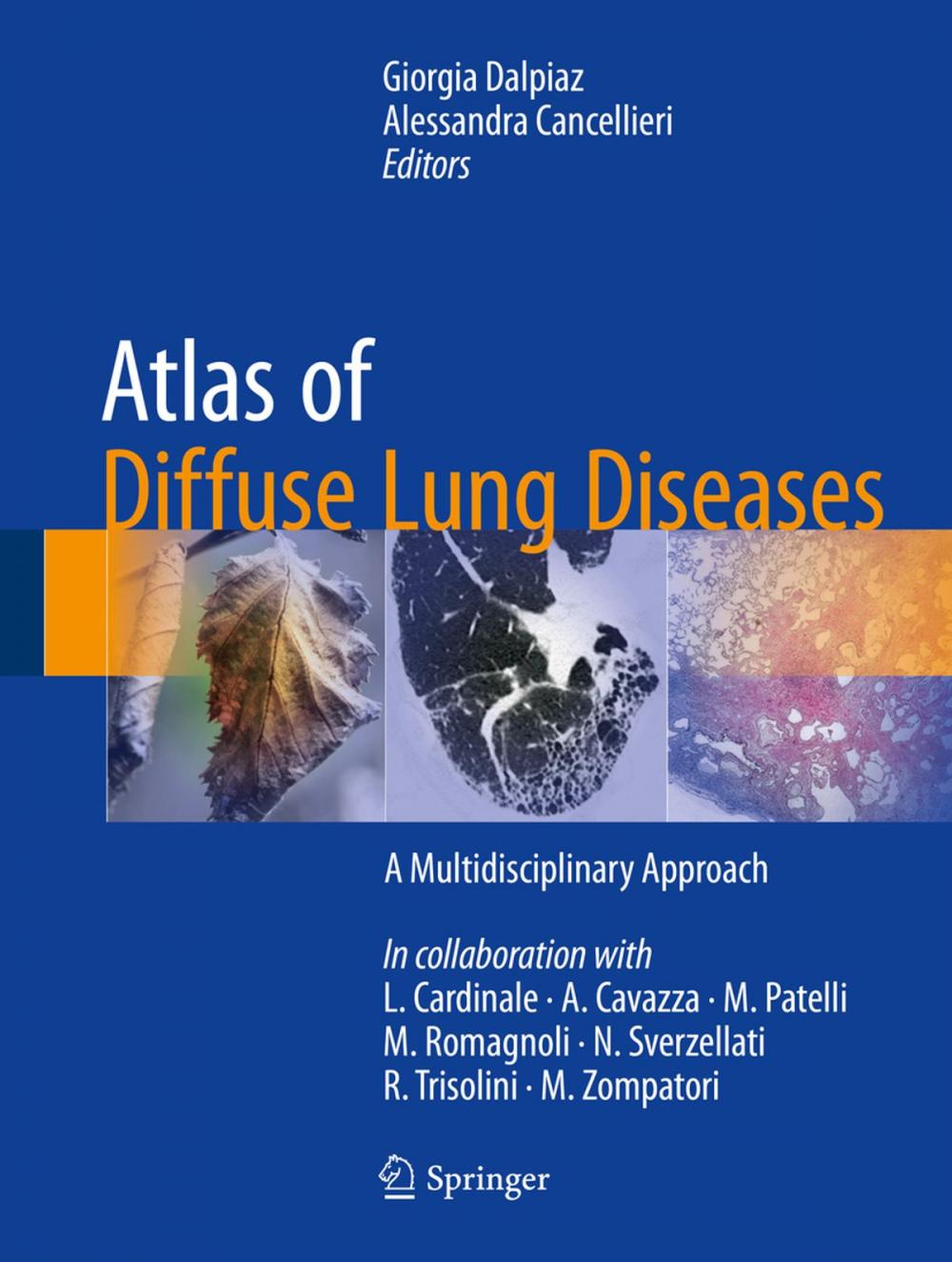 Big bigCover of Atlas of Diffuse Lung Diseases