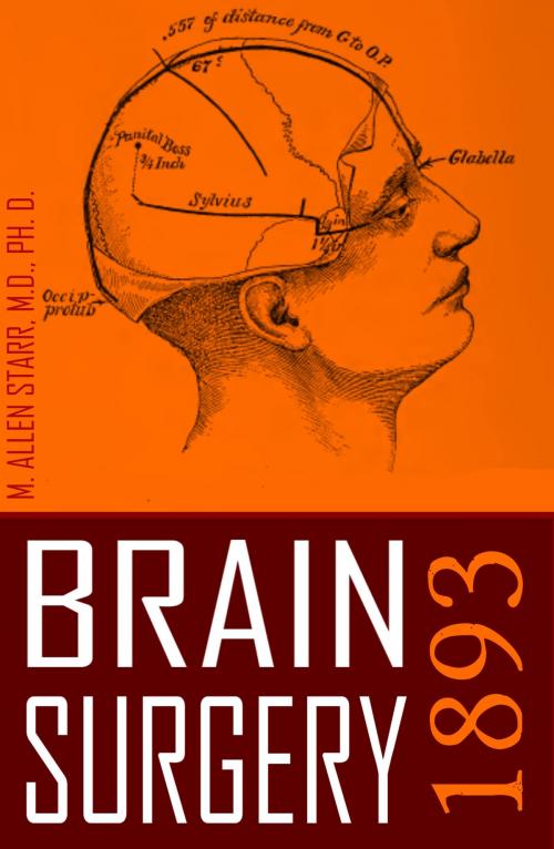 Cover of the book Brain Surgery: 1893 (Abridged, New Intro) by M. Allen Starr MD, BIG BYTE BOOKS