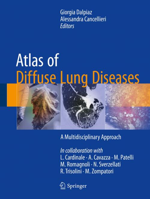 Cover of the book Atlas of Diffuse Lung Diseases by , Springer International Publishing