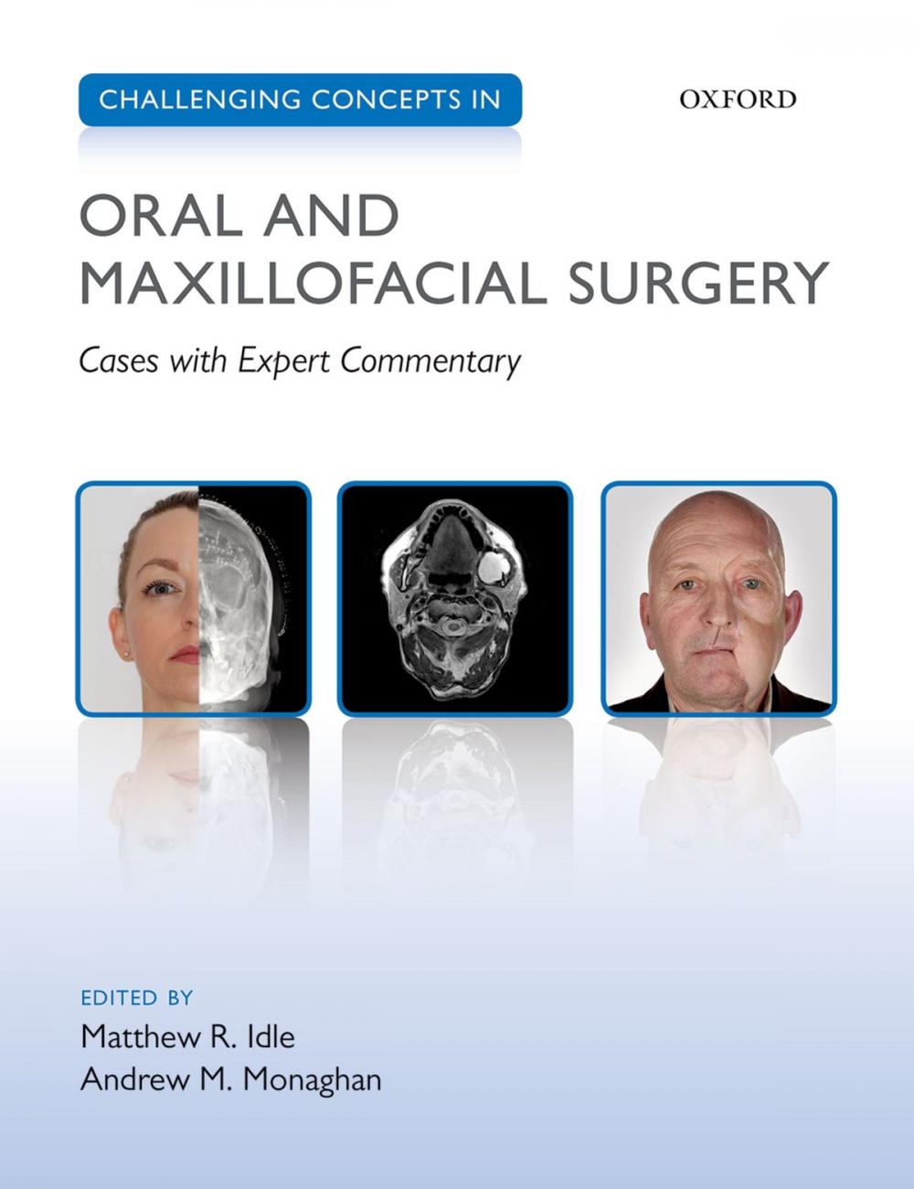 Big bigCover of Challenging Concepts in Oral and Maxillofacial Surgery