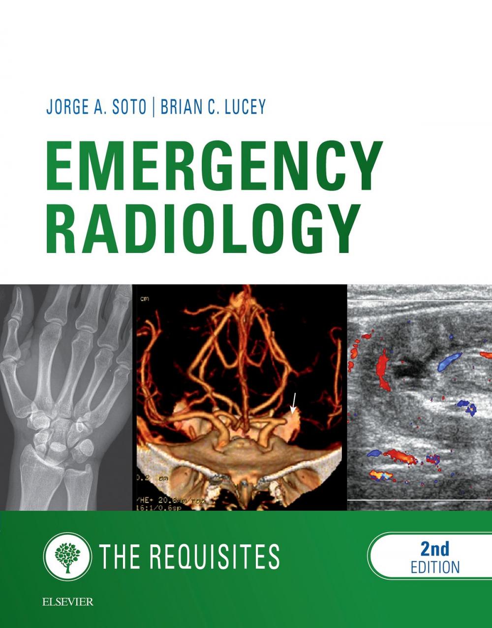 Big bigCover of Emergency Radiology: The Requisites E-Book