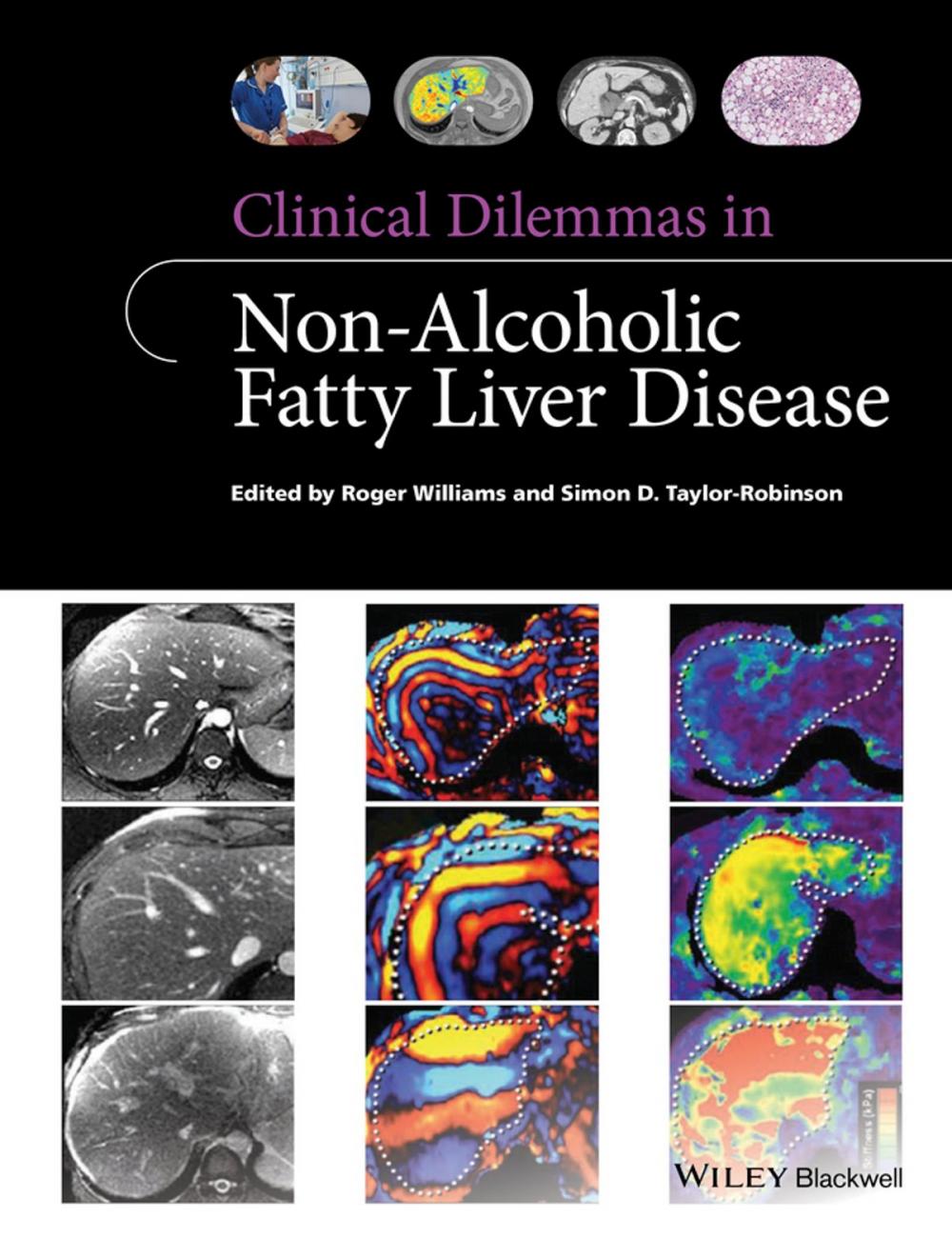 Big bigCover of Clinical Dilemmas in Non-Alcoholic Fatty Liver Disease