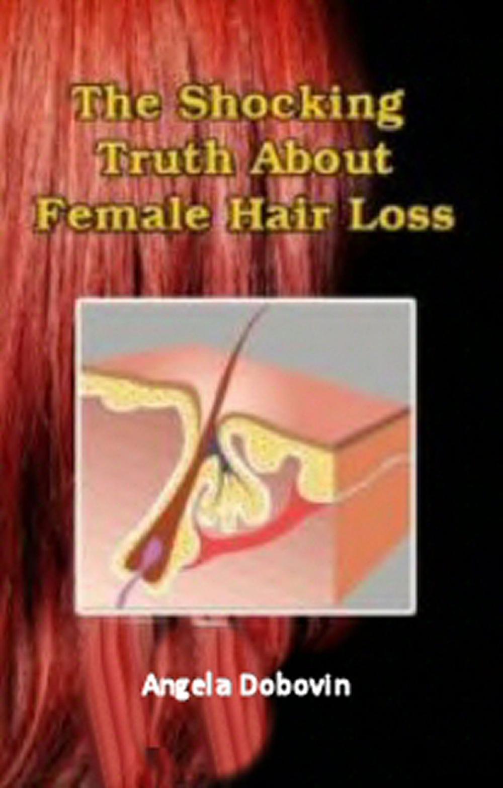 Big bigCover of The Shocking Truth About Female Hair Loss