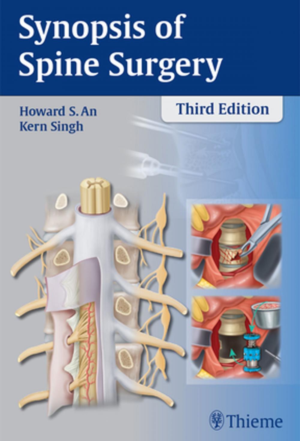 Big bigCover of Synopsis of Spine Surgery