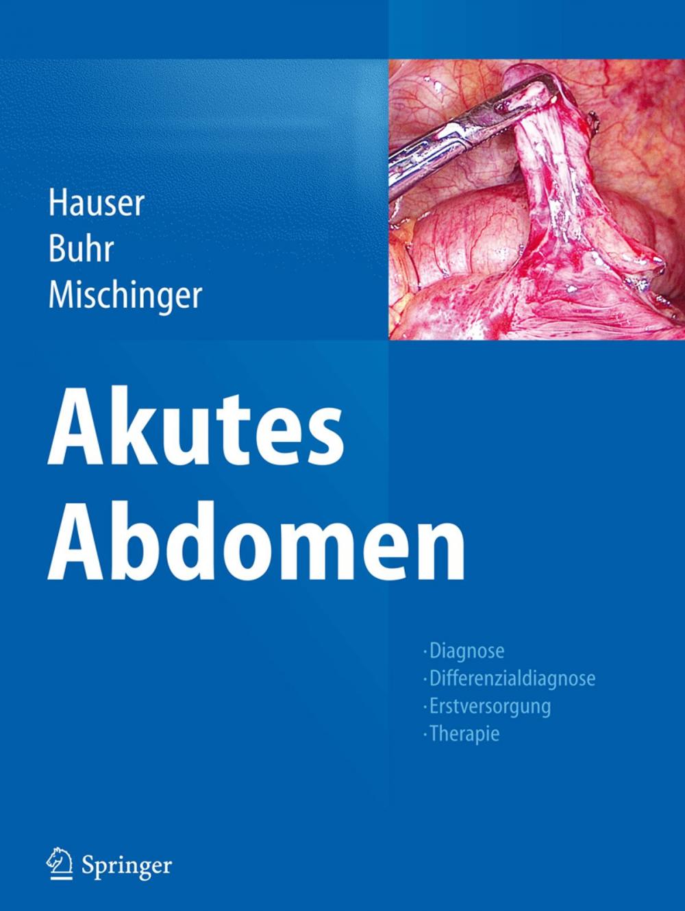 Big bigCover of Akutes Abdomen