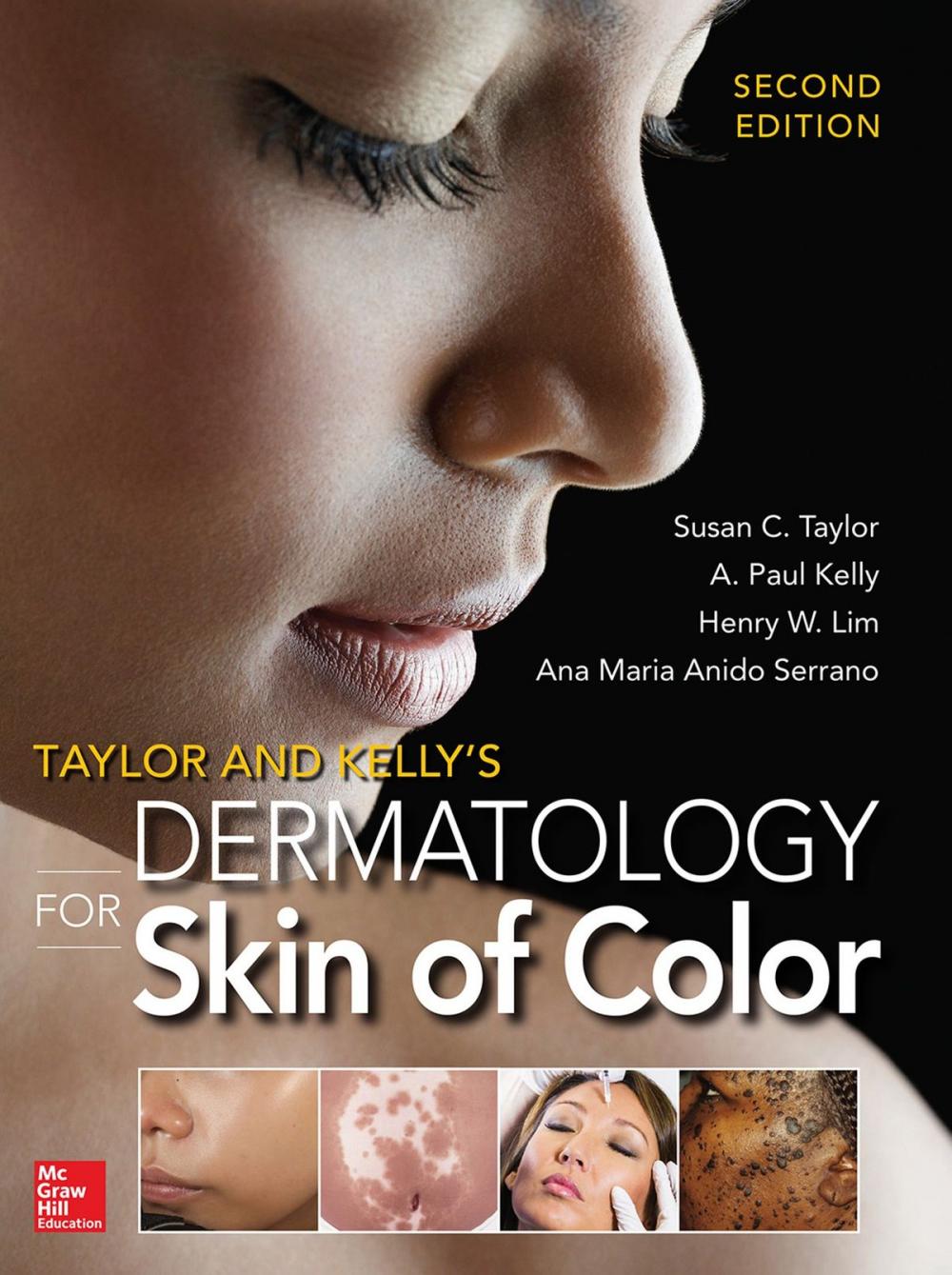 Big bigCover of Taylor and Kelly's Dermatology for Skin of Color 2/E