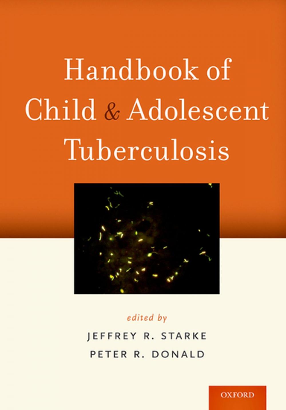 Big bigCover of Handbook of Child and Adolescent Tuberculosis