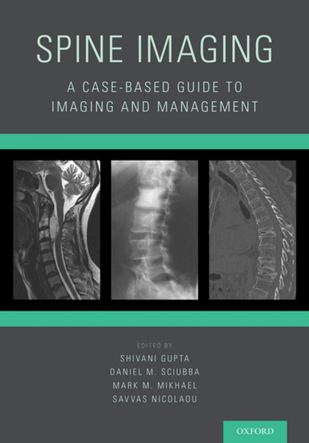 Big bigCover of Spine Imaging