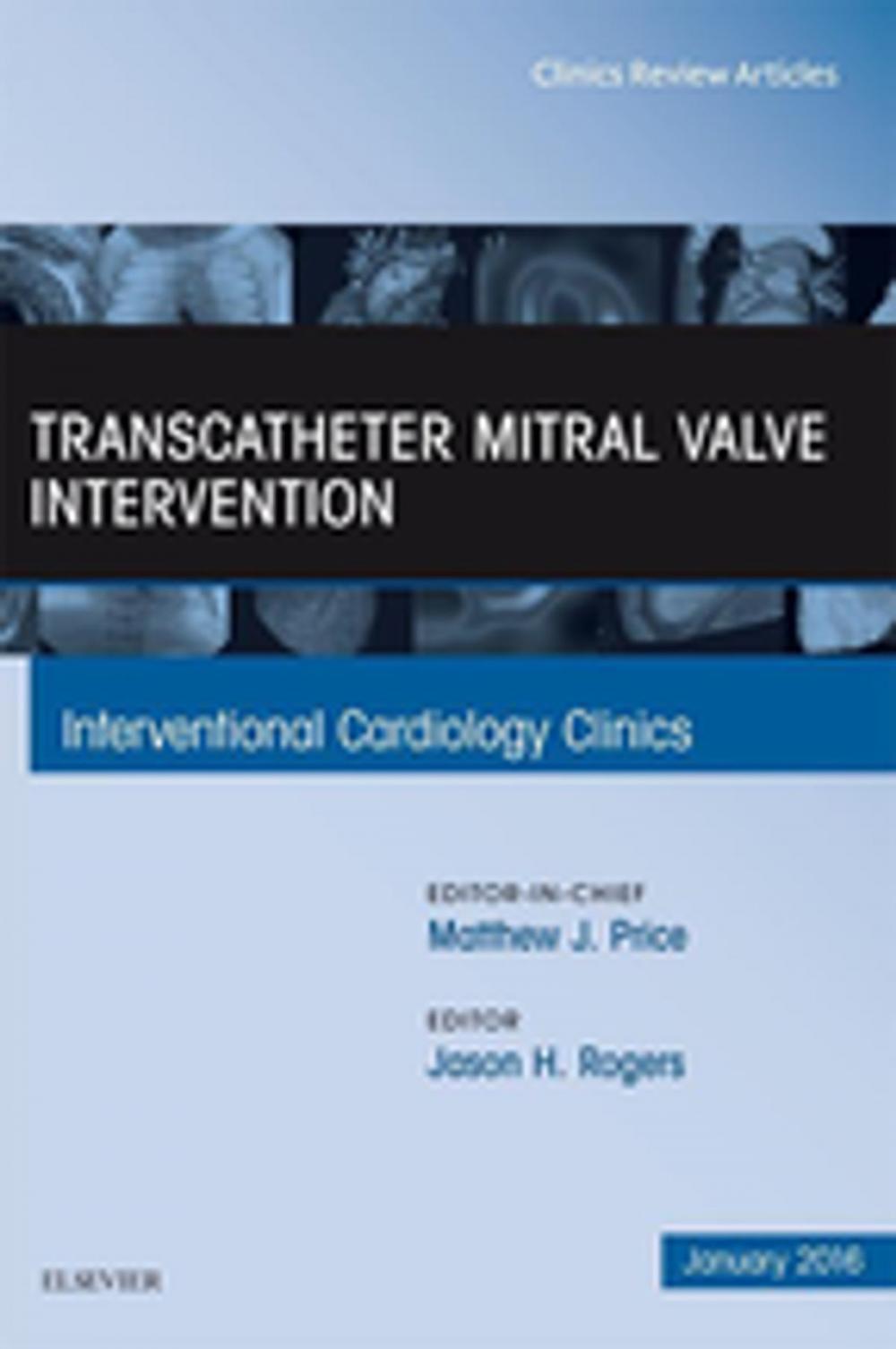 Big bigCover of Transcatheter Mitral Valve Intervention, An Issue of Interventional Cardiology Clinics, E-Book