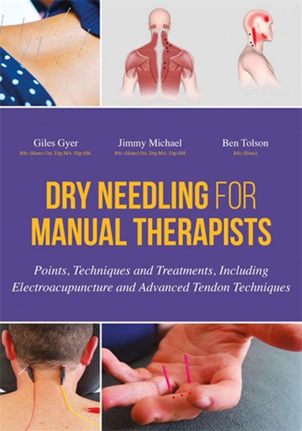 Big bigCover of Dry Needling for Manual Therapists