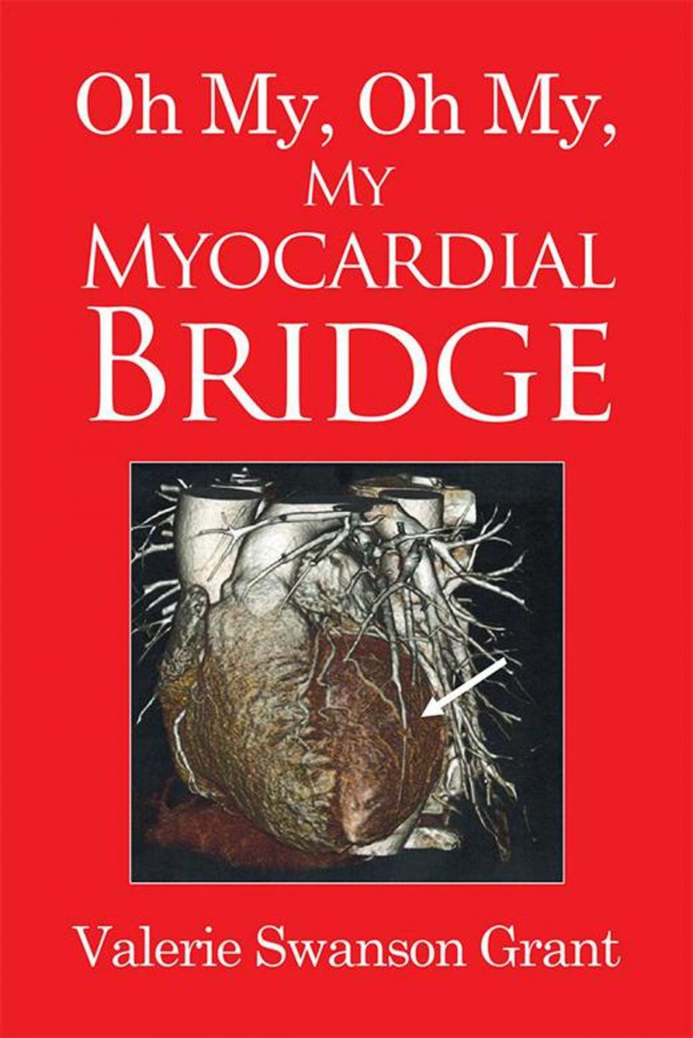 Big bigCover of Oh My, Oh My, My Myocardial Bridge