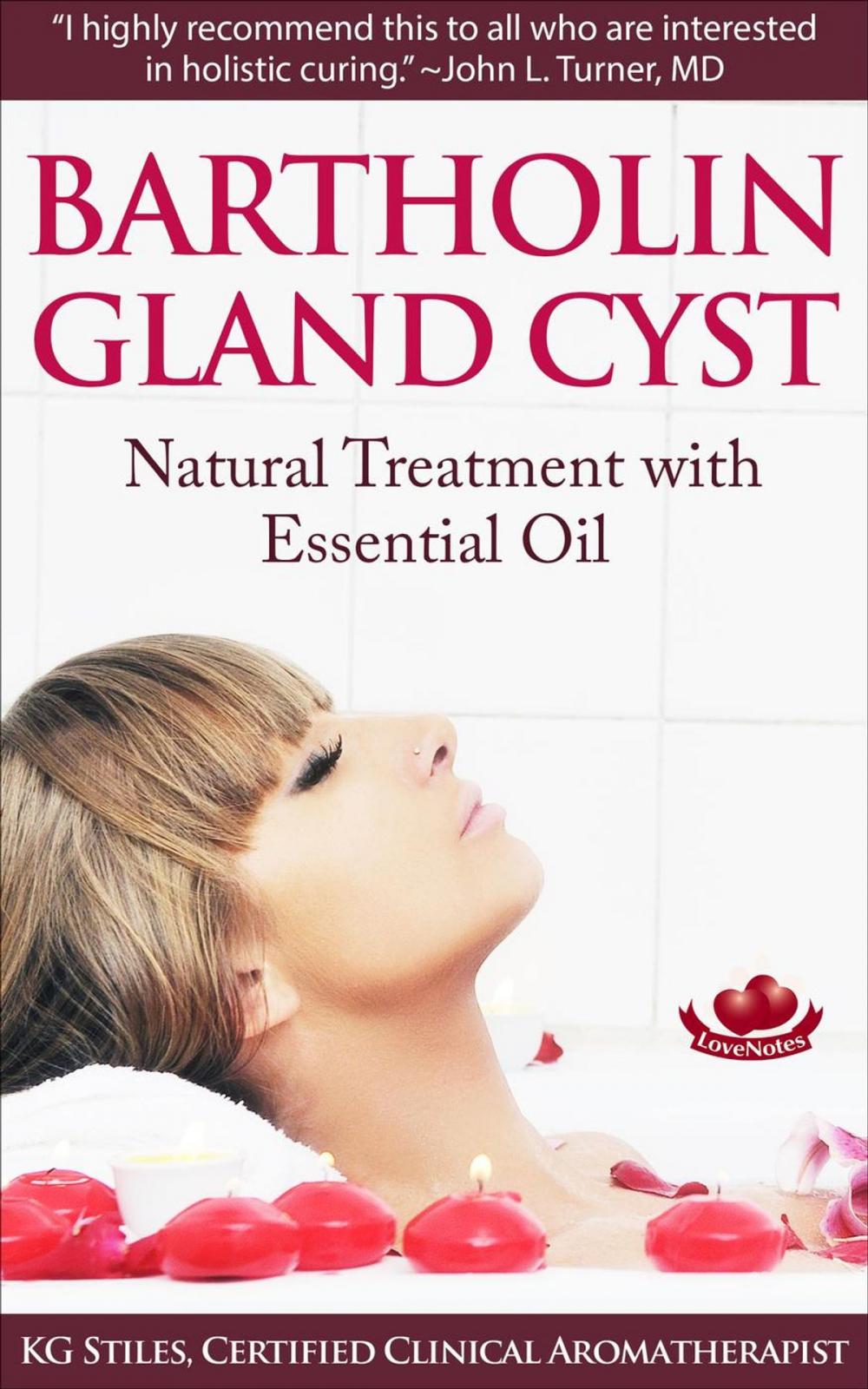 Big bigCover of Bartholin Gland Cyst - Natural Treatment with Essential Oil