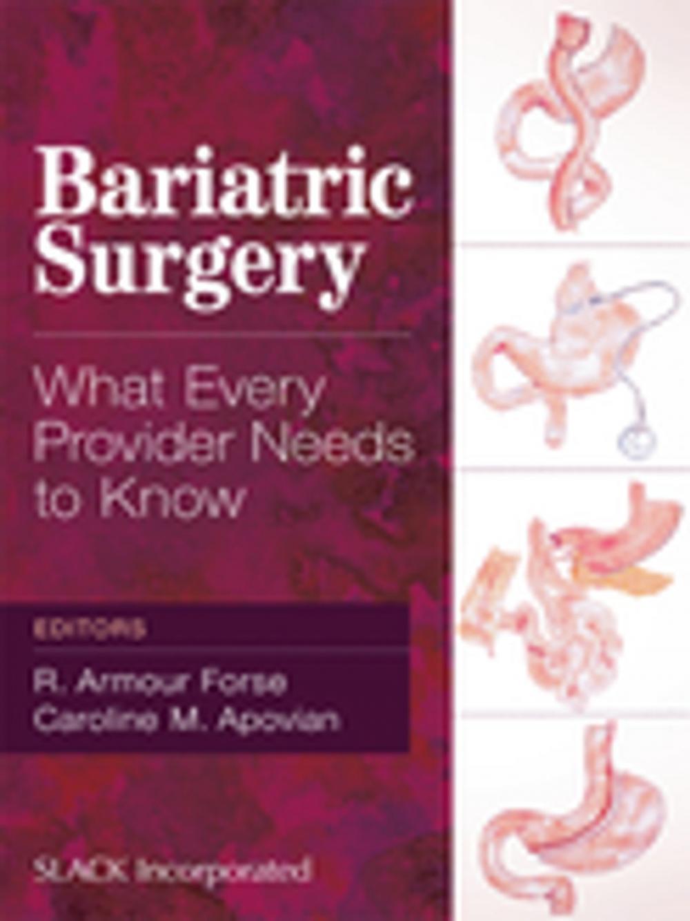 Big bigCover of Bariatric Surgery