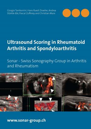 Cover of the book Ultrasound Scoring in Rheumatoid Arthritis and Spondyloarthritis by Andreas Albrecht, Daniel Bolender
